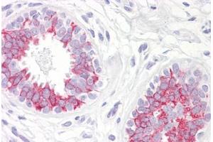 Anti-MAP2K1 / MEK1 antibody IHC staining of human breast. (MEK1 Antikörper  (AA 252-301))