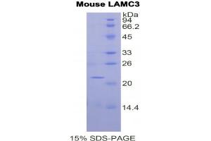 SDS-PAGE analysis of Mouse Laminin gamma 3 Protein. (LAMC3 Protein)