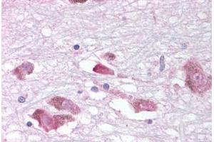 Human Brain, Substantia Nigra (formalin-fixed, paraffin-embedded) stained with MCHR1 antibody ABIN213354 at 10-18 ug/ml followed by biotinylated goat anti-rabbit IgG secondary antibody ABIN481713, alkaline phosphatase-streptavidin and chromogen. (MCHR1 Antikörper  (C-Term))