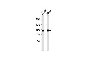 Western blot analysis of lysates from A549, Hela cell line (from left to right), using Mouse Fgfr3 Antibody (Center) (ABIN6242233 and ABIN6577519). (FGFR3 Antikörper  (AA 449-482))