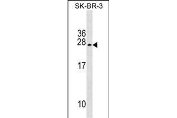 TUSC5 Antikörper  (AA 78-104)