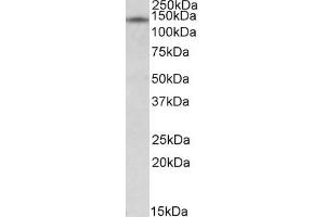 Western Blotting (WB) image for anti-Nuclear Receptor Interacting Protein 1 (NRIP1) antibody (ABIN5881688) (NRIP1 Antikörper)