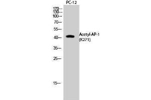 Western Blotting (WB) image for anti-Jun Proto-Oncogene (JUN) (acLys271) antibody (ABIN3178880) (C-JUN Antikörper  (acLys271))