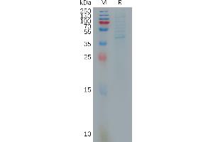 Human XA Protein, hFc Tag on SDS-PAGE under reducing condition. (XAGE1 Protein (Fc Tag))
