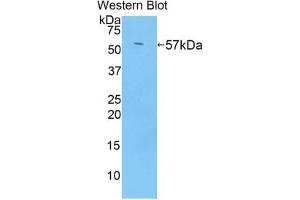 Western blot analysis of the recombinant protein. (TGM1 Antikörper  (AA 433-692))