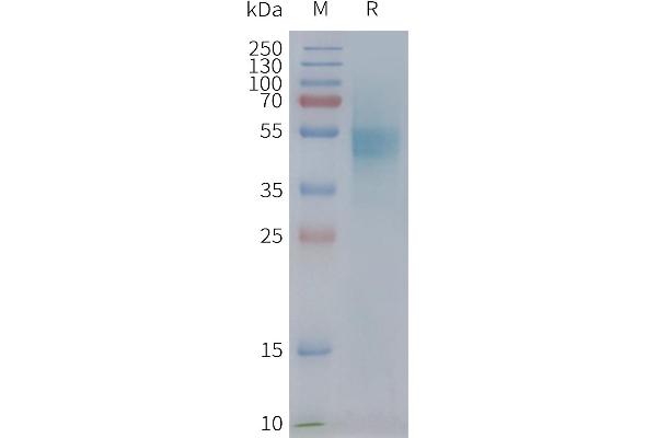 CXCR1 Protein