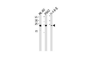 Western blot analysis in HL-60,K562,H-4-II-E cell line lysates (35ug/lane). (HMGB2 Antikörper  (AA 92-118))