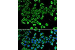 Immunofluorescence analysis of A-549 cells using LCN2 Polyclonal Antibody (Lipocalin 2 Antikörper)