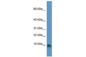 EGF antibody used at 1 ug/ml to detect target protein. (EGF Antikörper)