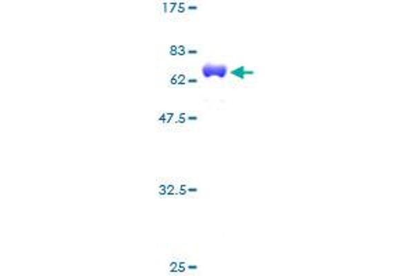 CKB Protein (AA 1-381) (GST tag)