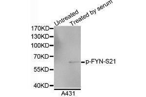 Western blot analysis of extracts of A4731 cells, using Phospho-FYN-S21 antibody. (FYN Antikörper  (pSer21))