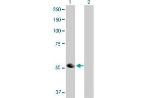 Western Blot analysis of TRIP6 expression in transfected 293T cell line by TRIP6 MaxPab polyclonal antibody. (TRIP6 Antikörper  (AA 1-476))
