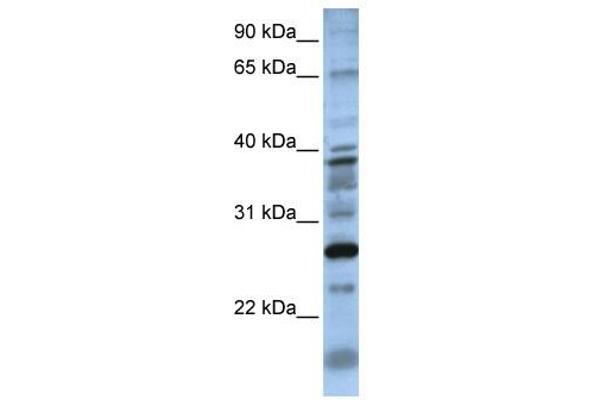 DOLPP1 Antikörper  (N-Term)