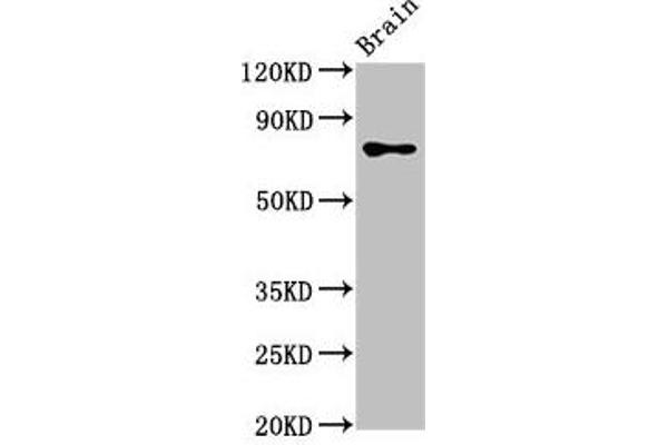 CASC1 Antikörper  (AA 1-300)