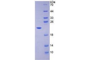 SDS-PAGE analysis of Mouse Caspase 3 Protein. (Caspase 3 Protein (CASP3))