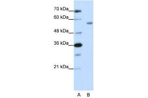 Western Blot showing ZNF497 antibody used at a concentration of 1-2 ug/ml to detect its target protein. (ZNF497 Antikörper  (N-Term))