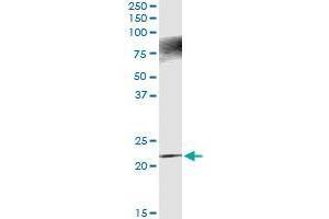 Immunoprecipitation of APOBEC3C transfected lysate using rabbit polyclonal anti-APOBEC3C and Protein A Magnetic Bead (APOBEC3C (Human) IP-WB Antibody Pair)