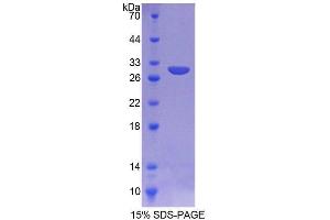 SDS-PAGE (SDS) image for Aspartylglucosaminidase (AGA) (AA 24-260) protein (His tag) (ABIN4989161) (AGA Protein (AA 24-260) (His tag))