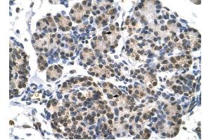 DHX9 antibody was used for immunohistochemistry at a concentration of 4-8 ug/ml to stain Epithelial cells of pancreatic acinus (arrows) in Human Pancreas. (DHX9 Antikörper)