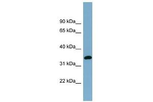 AWAT1 antibody used at 1 ug/ml to detect target protein. (AWAT1 Antikörper  (N-Term))