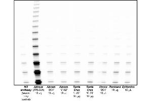 Antibodies and their commercial vendor are described, based on immunoprecipitation of telomerase from HEK-293 tumour cell lysates, followed by a 1 hr elution in the presence of antigenic peptide, if available. (hTERT Antikörper)