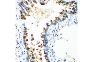 Immunohistochemistry of paraffin-embedded rat lung using MT-CO2 antibody (ABIN4903355) at dilution of 1:100 (40x lens). (COX2 Antikörper)