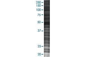 DOC2B transfected lysate. (DOC2B 293T Cell Transient Overexpression Lysate(Denatured))