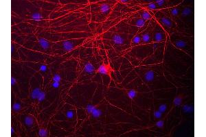 View of mixed neuron/glial cultures stained with NEFM / NF-M antibody (red). (NEFM Antikörper)