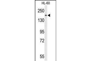 Western blot analysis of PLCB1 Antibody in HL-60 cell line lysates (35ug/lane) (Phospholipase C beta 1 Antikörper  (C-Term))