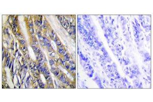 Immunohistochemistry (IHC) image for anti-Diacylglycerol Kinase, eta (DGKH) (Internal Region) antibody (ABIN1849746) (DGKH Antikörper  (Internal Region))