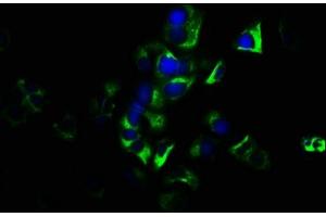 Immunofluorescence staining of MCF-7 cells with ABIN7154680 at 1:133, counter-stained with DAPI. (GNG7 Antikörper  (AA 2-65))