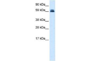 Western Blot showing ZNF499 antibody used at a concentration of 1-2 ug/ml to detect its target protein. (ZBTB45 Antikörper  (Middle Region))