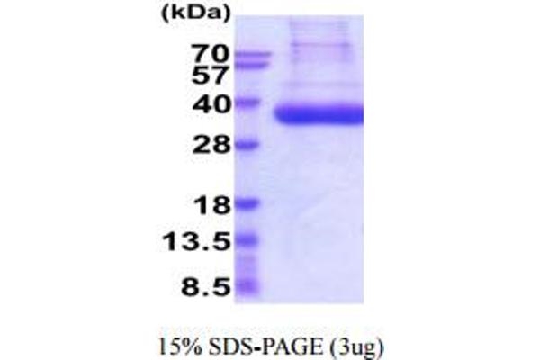 PLAT Protein (AA 36-310) (His tag)