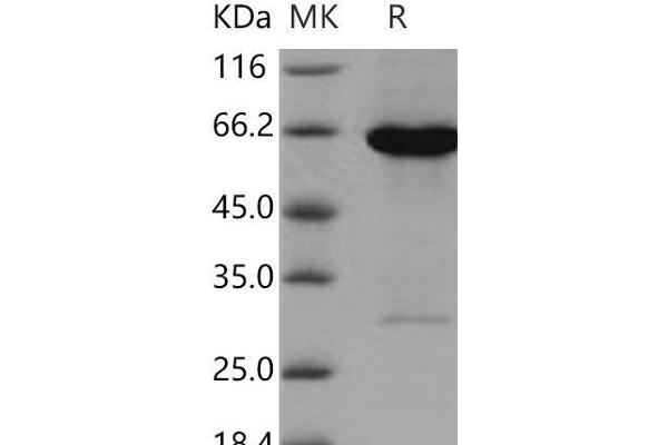 ADK Protein (GST tag,His tag)