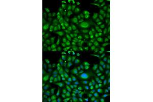 Immunofluorescence analysis of U2OS cells using HSPA1L antibody. (HSPA1L Antikörper)
