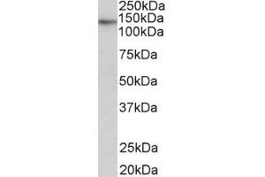 Western Blotting (WB) image for anti-Telomerase Reverse Transcriptase (TERT) (AA 597-611) antibody (ABIN1104625) (TERT Antikörper  (AA 597-611))