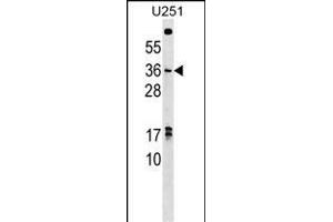 NKX3-1 Antibody (C-term) (ABIN1536752 and ABIN2848824) western blot analysis in  cell line lysates (35 μg/lane). (NKX3-1 Antikörper  (C-Term))