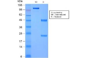 SDS-PAGE (SDS) image for anti-Moesin (MSN) antibody (ABIN6940086)