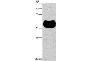 Western blot analysis of Human fetal muscle tissue, using HRH2 Polyclonal Antibody at dilution of 1:300 (HRH2 Antikörper)