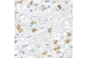 Immunohistochemistry of paraffin-embedded rat brain using PIP4K2B antibody. (PIP4K2B Antikörper)