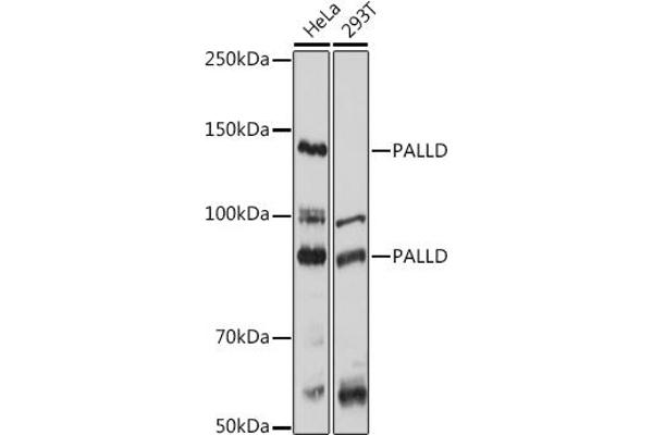 PALLD Antikörper  (AA 383-672)