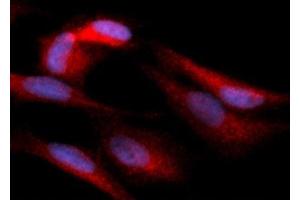 Immunofluorescence (IF) image for anti-Hexokinase 1 (HK1) (AA 1-917) antibody (PE) (ABIN5567562) (Hexokinase 1 Antikörper  (AA 1-917) (PE))
