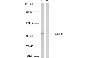 Western blot analysis of extracts from HeLa cells treated with UV, using CREB (Ab-129/133) antibody (#B7053). (CREB1 Antikörper  (Ser129, Ser133))