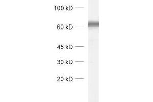 dilution: 1 : 1000, sample: synaptic membrane fraction (LP1) of rat brain (SLC6A1 Antikörper)
