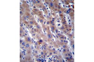 Immunohistochemistry (Paraffin-embedded Sections) (IHC (p)) image for anti-Fatty Acid Desaturase 2 (FADS2) (AA 79-108), (N-Term) antibody (ABIN656230)