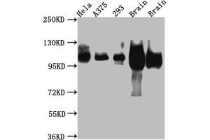 Western Blot Positive WB detected in: Hela whole cell lysate, A375 whole cell lysate, HEK293 whole cell lysate, Rat Brain whole cell lysate, Mouse Brain whole cell lysate All lanes: Amyloid beta A4 antibody at 1:1000 Secondary Goat polyclonal to rabbit IgG at 1/50000 dilution Predicted band size: 87, 35, 77, 79, 79, 81, 83, 85, 86, 73, 85 kDa Observed band size: 100 kDa (Rekombinanter APP Antikörper)