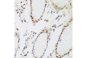 Immunohistochemistry of paraffin-embedded human stomach using PPAN antibody. (PPAN Antikörper)