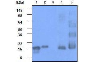 Western Blotting (WB) image for anti-Synuclein, alpha (SNCA) (AA 119-140) antibody (ABIN317562) (SNCA Antikörper  (AA 119-140))