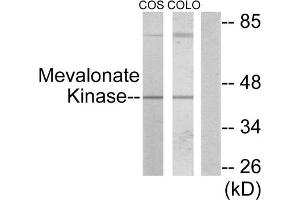 Western blot analysis of extracts from COS-7 cells and COLO205 cells, using Mevalonate Kinase antibody. (MVK Antikörper  (Internal Region))