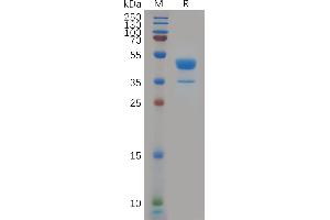 Human C Protein, hFc Tag on SDS-PAGE under reducing condition. (CXCR2 Protein (AA 1-48) (Fc Tag))
